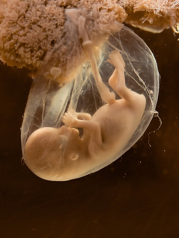 Myös munasolujen vanheneminen kasvattaa raskauden riskejä. Lapsentekoon kuitenkin ryhdytään entistä myöhemmällä iällä. Kuva. iStockphoto