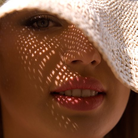 ruusufinni, aurinkosuoja