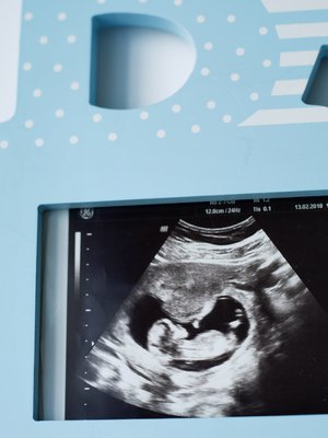 Synnytyksen ennakoimattomuus voi tuntua vaikealta, jos on tottunut kontrolloimaan asioita elämässään. Kuva: <span class="photographer">Milka Alanen</span>