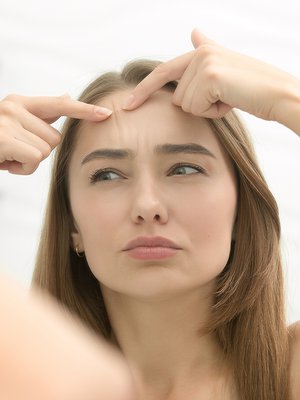 akne, minipillerit, hormonit