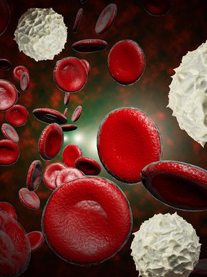 veren valkosolut, tulehdus, verisyöpä, leukemia