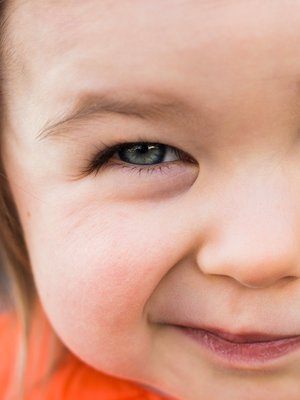 Toisen silmän sulkeminen voi olla merkki siitä, että lapsi yrittää nähdä paremmin. Kuva: <span class="photographer">Shutterstock</span>