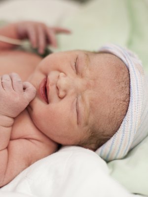 Keisarileikkaus on maailman yleisin laajamittainen kirurginen toimenpide. 