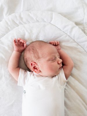 Vauvan vino pään muoto on harvoin haitallista. Kuva: <span class="photographer">iStockphoto</span>