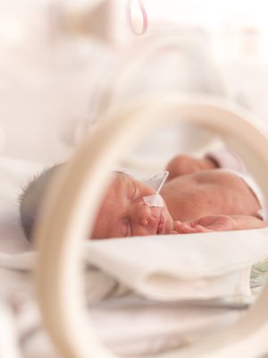 Maailmalla yli 15 miljoonaa lasta syntyy ennenaikaisesti joka vuosi. Kuva: <span class="photographer">iStockPhoto</span>