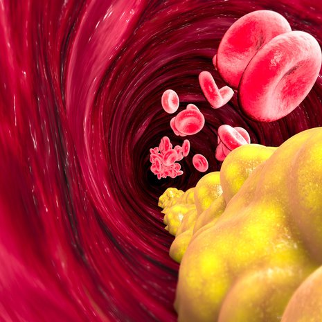 Sekä hyvä että huono kolesteroli kulkee verisuonissa lipoproteiiniin pakattuna.