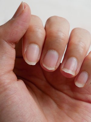 Kuva: <span class="photographer">Shutterstock</span>