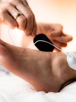 Kotikäyttöiset TENS-laitteet hyödyntävät samoja kipupisteitä kuin akupunktio, mutta neulojen sijasta niitä ärsytetään sähköllä.