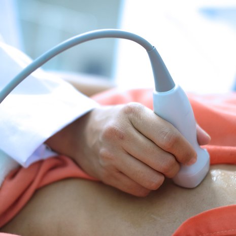  Kysta eli nesterakkula löytyy yleensä muusta syystä tehdyn vatsan alueen kuvantamistutkimuksen sivulöydöksenä.