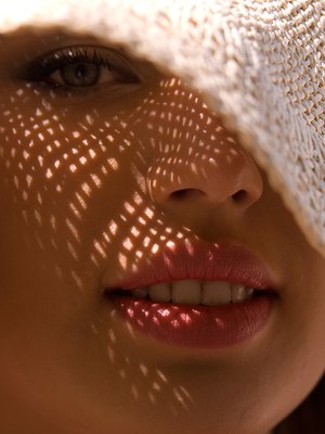 ruusufinni, aurinkosuoja